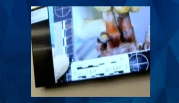 Disturbing Autopsy Images That Went Viral |