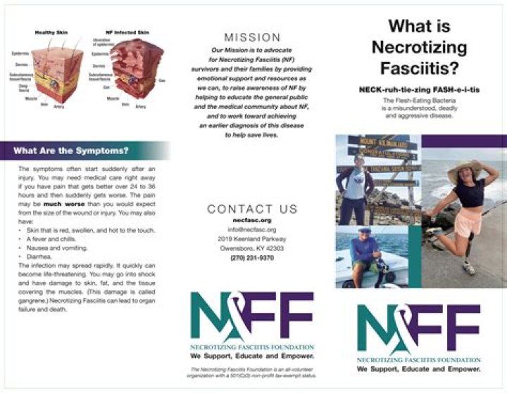 What You Need to Know About Necrotizing Fasciitis |